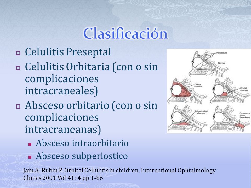 celulitis periorbitaria pediatria celulitis periorbitaria pediatria
